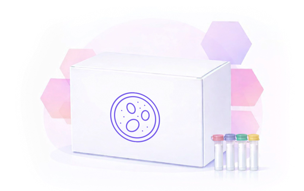 2019-nCoV (SARS-CoV-2) Detection Kit